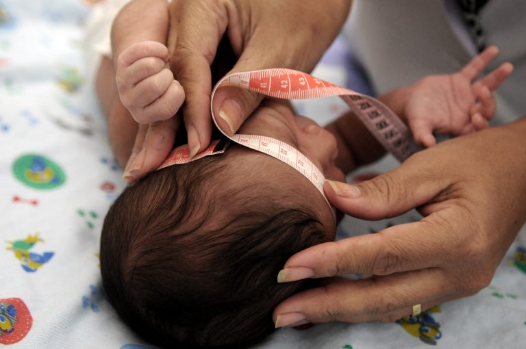 Saúde - geral - microcefalia pediatria crianças hospitais médicos atendimento enfermagem saúde da família